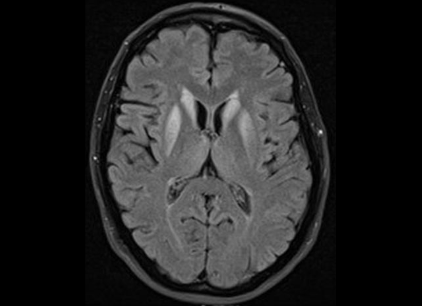 Neurology Images | Brain Imaging Techniques & Analysis