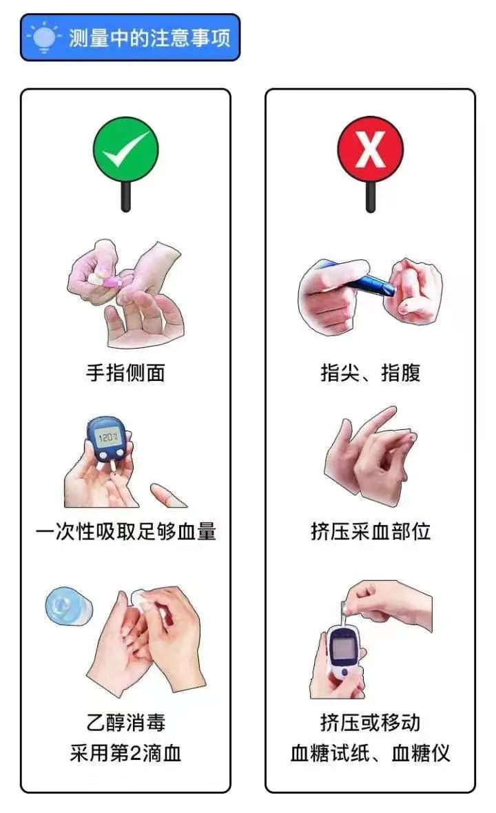 血糖监测技术示意图