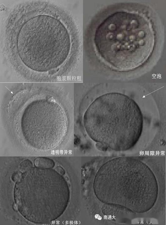 卵母细胞线粒体显微结构图