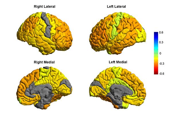 Cerveau bipolarité neurosciences