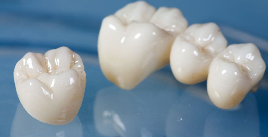Zirconia Crown