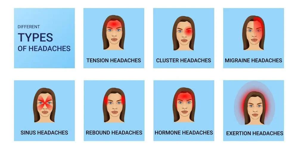 Comprehensive headache types classification infographic