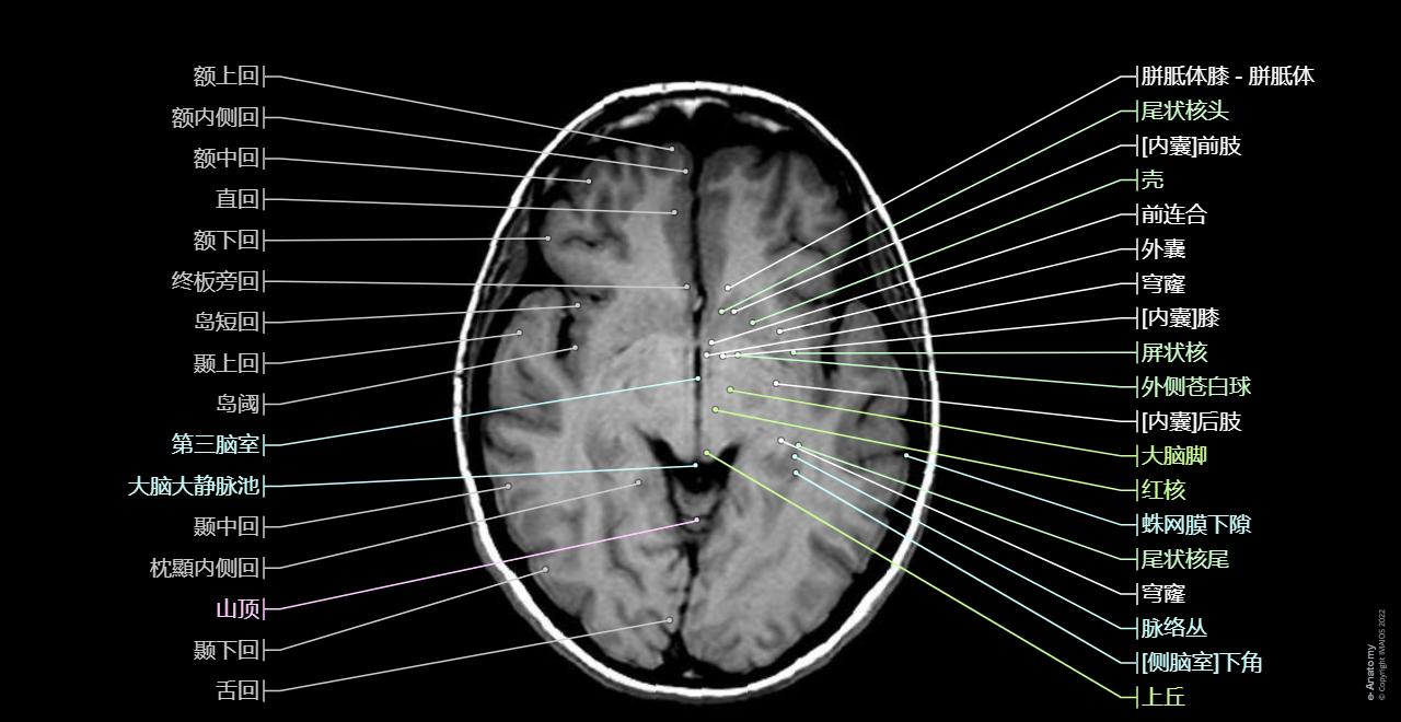 脑部MRI医学影像