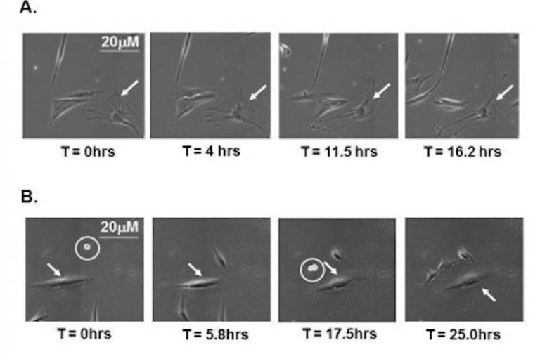 Microscopia de células humanas em diferentes estágios de rejuvenescimento laboratorial