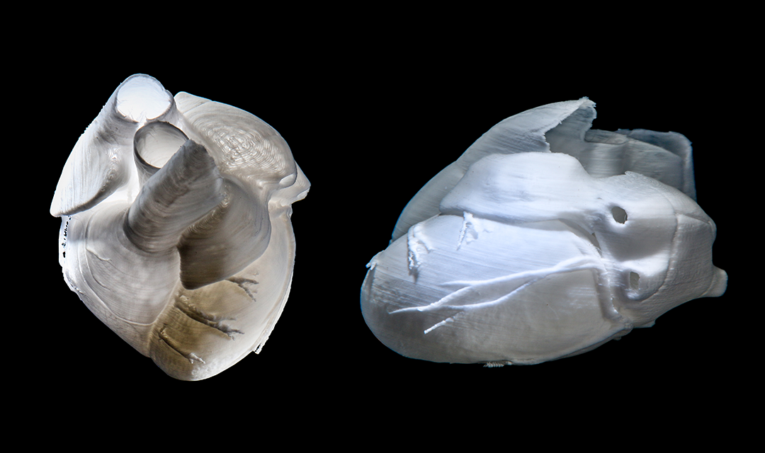 3D bioprinter creating tissue structures