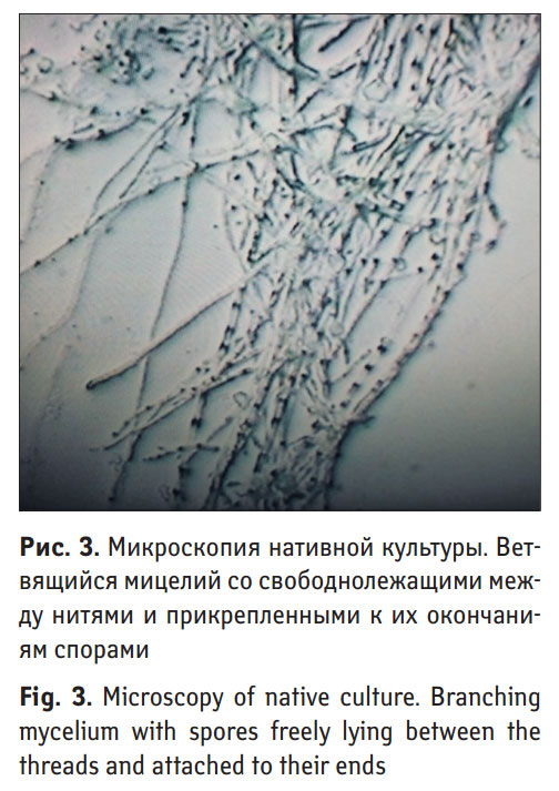 Мицеллы под микроскопом