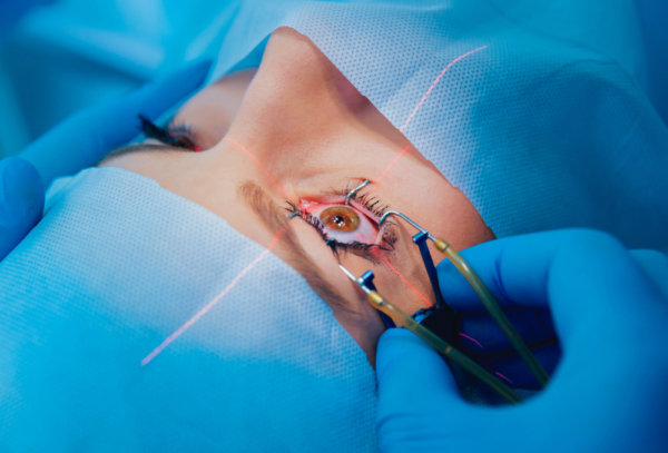 What Is LASIK Surgery? | Fort Lauderdale Eye Institute
