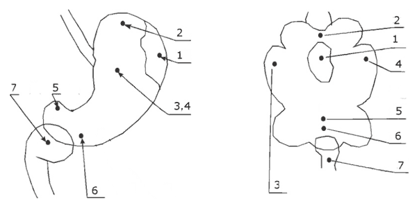 Точки pH-мониторинга