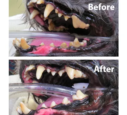 Before and After Dental Cleaning