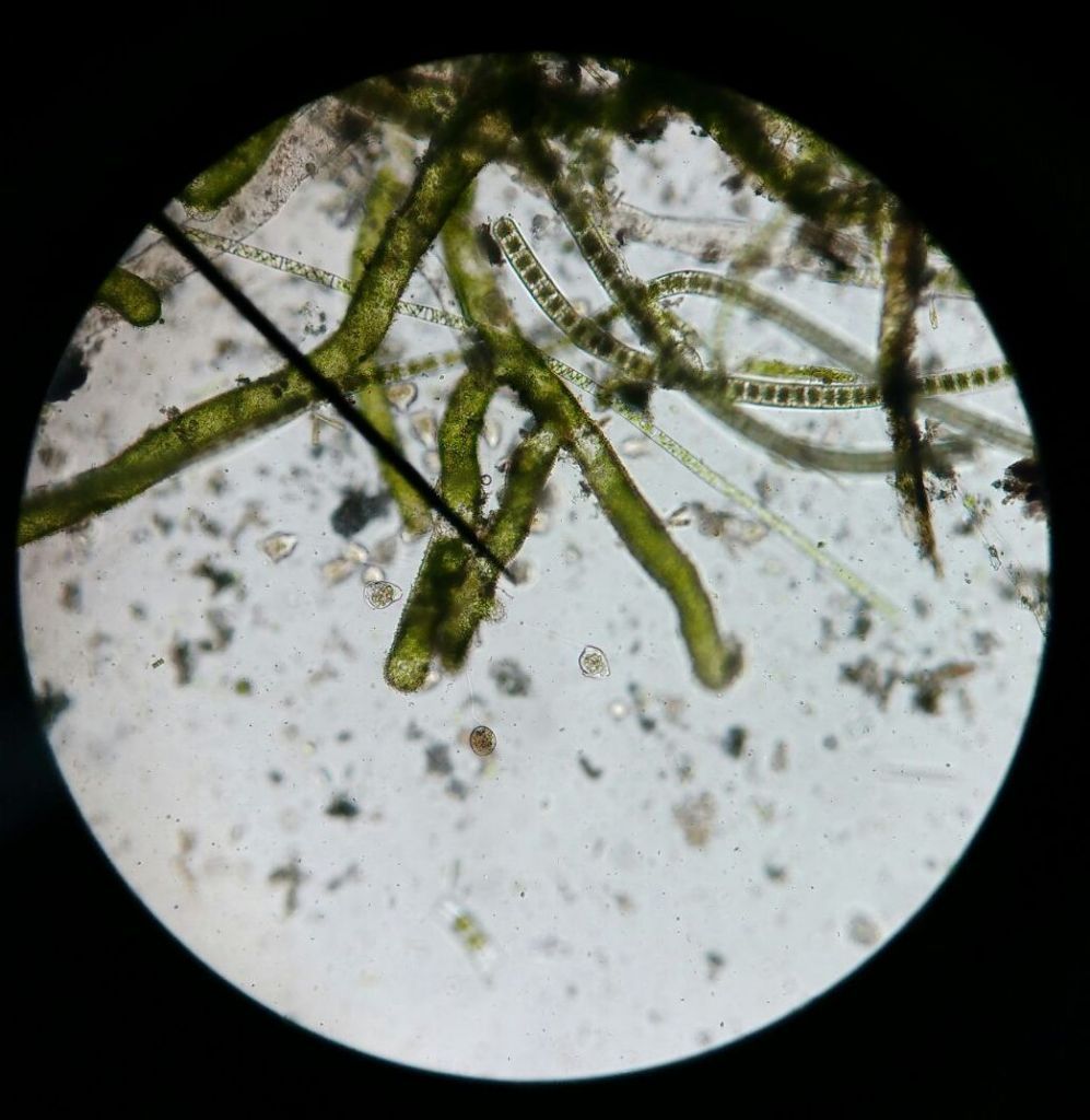 Microorganismos en agua contaminada vista microscopio