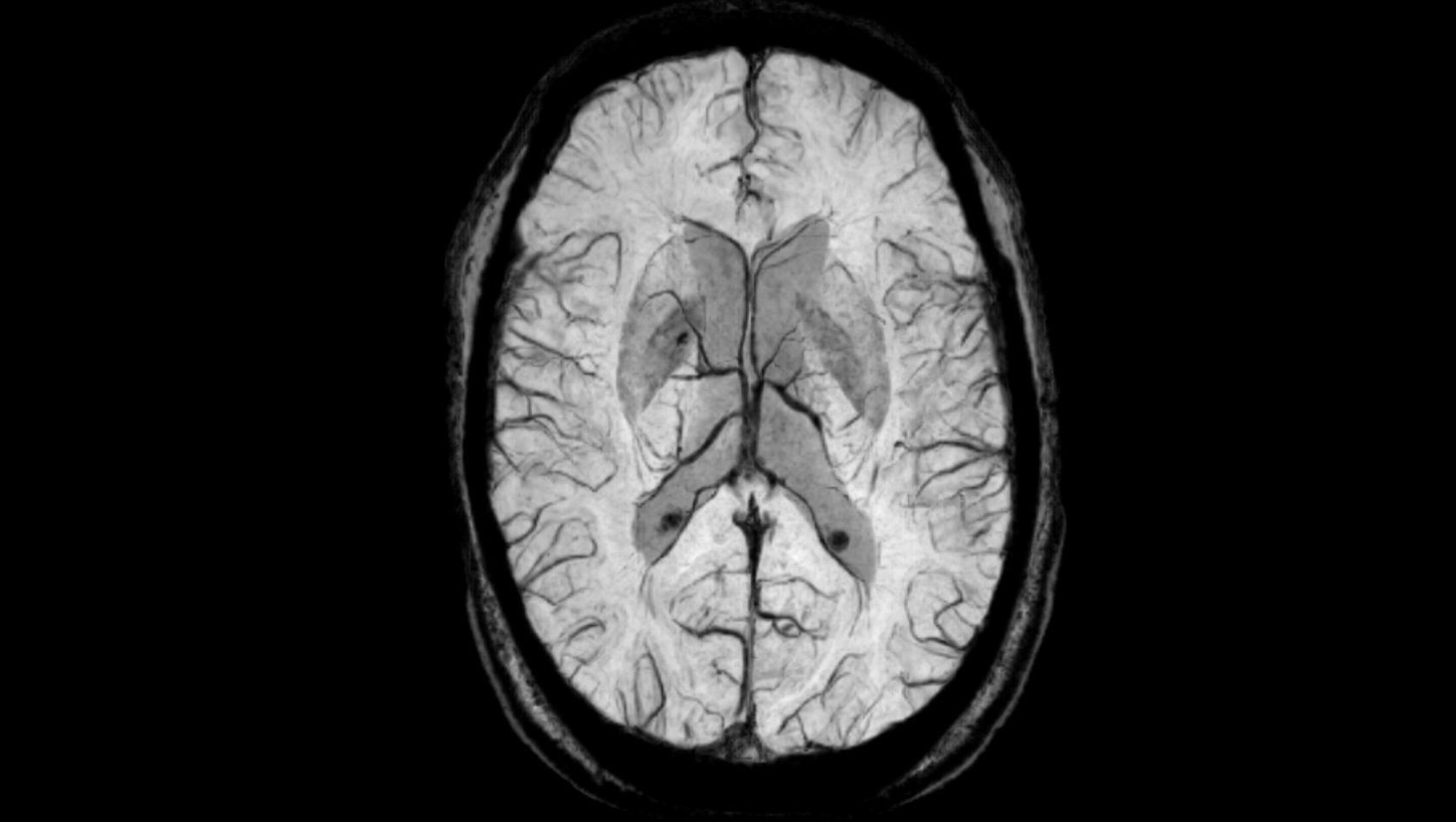 Neurology MRI - Siemens Healthineers USA