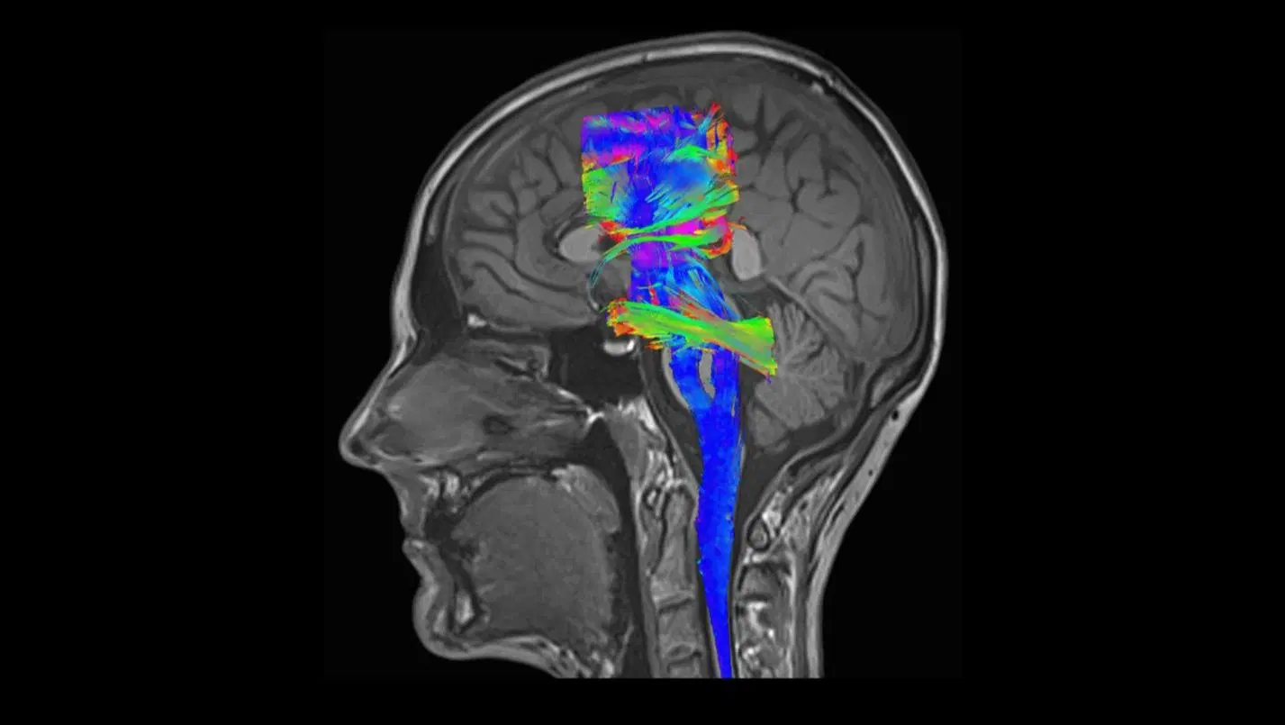 Neurology MRI - Siemens Healthineers USA