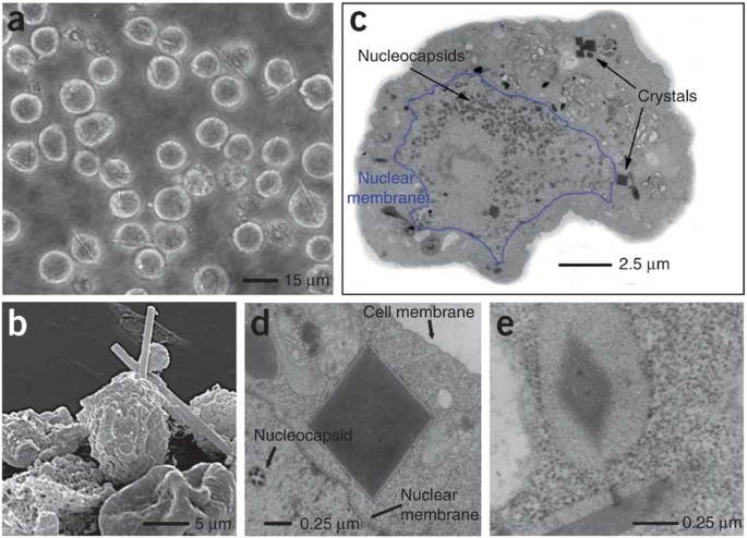 Microscopic observation of in vivo protein crystallization showing crystals forming inside cells