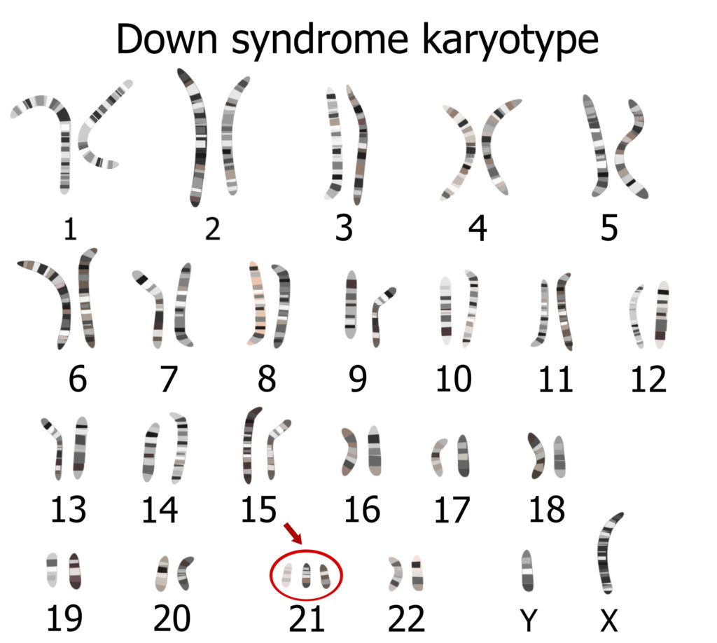 Genetic and chromosomal causes of miscarriage | Miscarriage Hope Desk