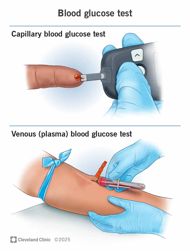 Blood glucose testing procedure illustration