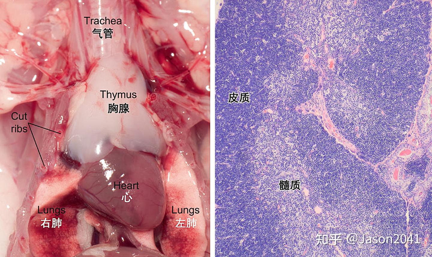 胸腺退化过程示意图