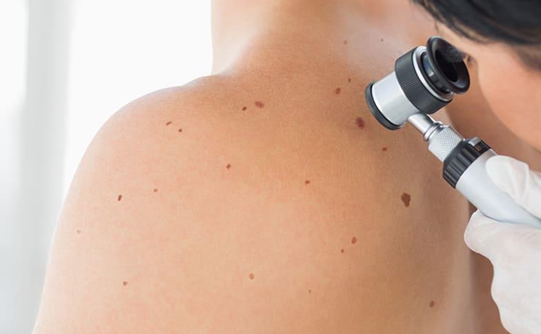 What to expect from your full body skin check appointment: Holly Hanson, MD: Board-Certified Dermatologists