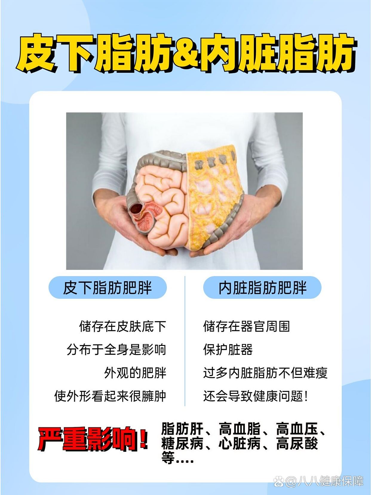 内脏脂肪与皮下脂肪的对比示意图