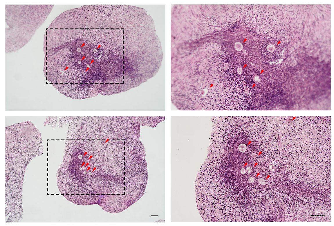 显微镜下的卵巢组织切片
