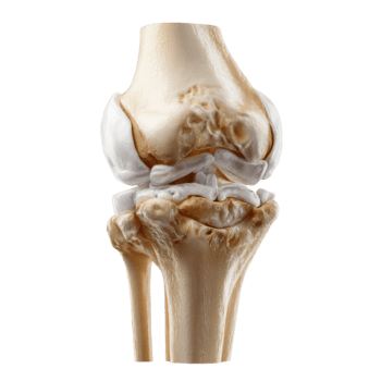 Orthopaedic
