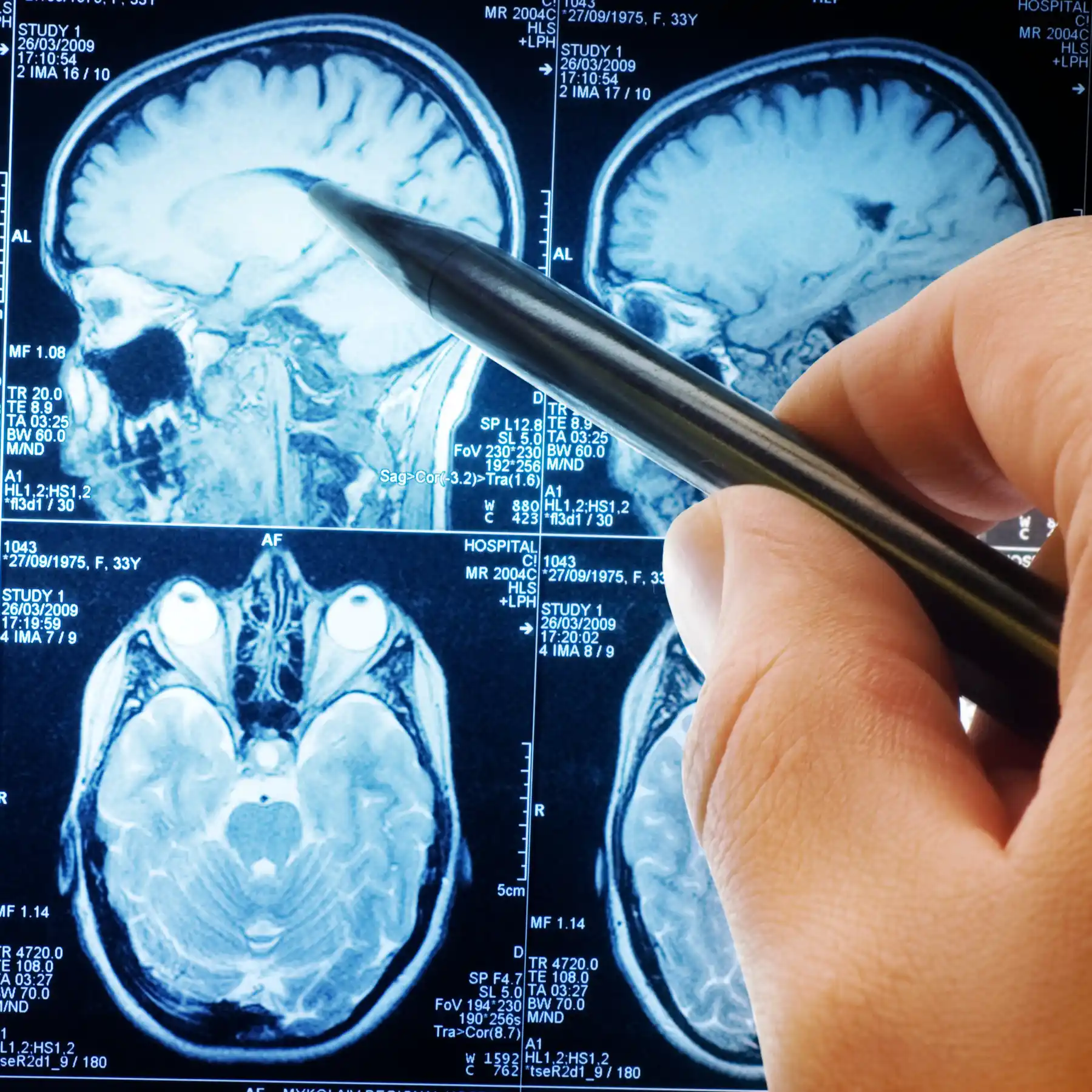 Neuroradiology MRI in Eau Claire | Medicare Radiology Clinic