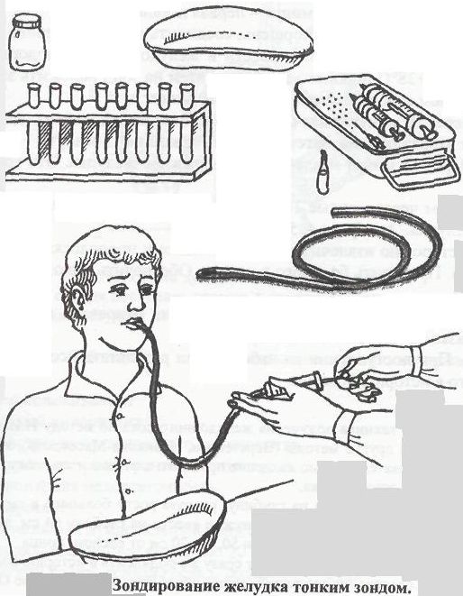 Алгоритм зондирования