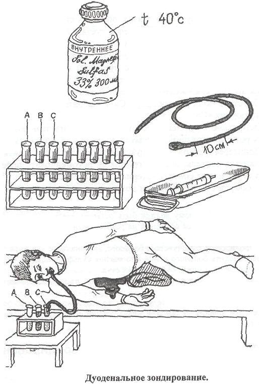 Дуоденальное зондирование