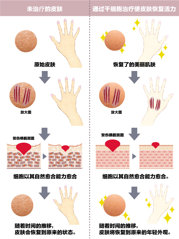 PRP治疗的抽象视觉效果