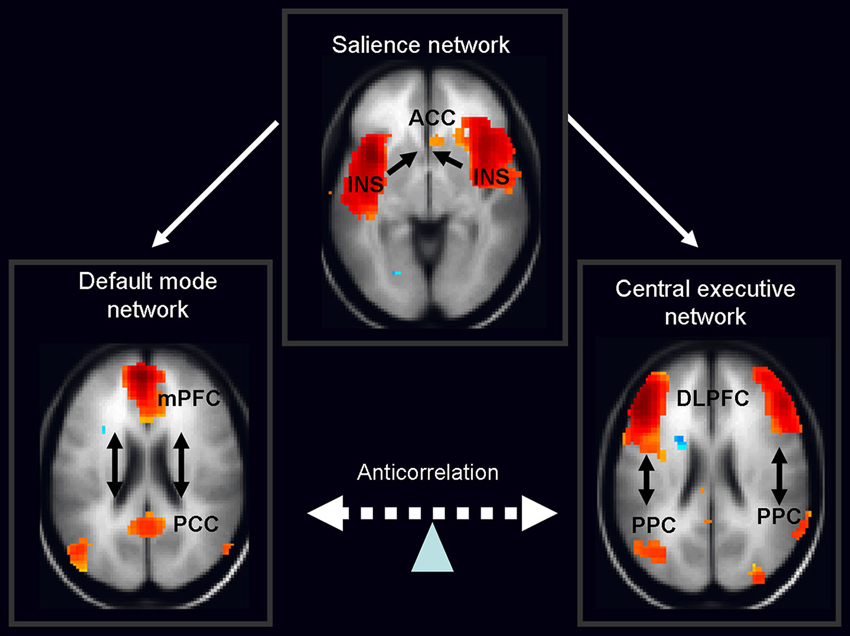 fMRI scan highlighting brain's frontoparietal network