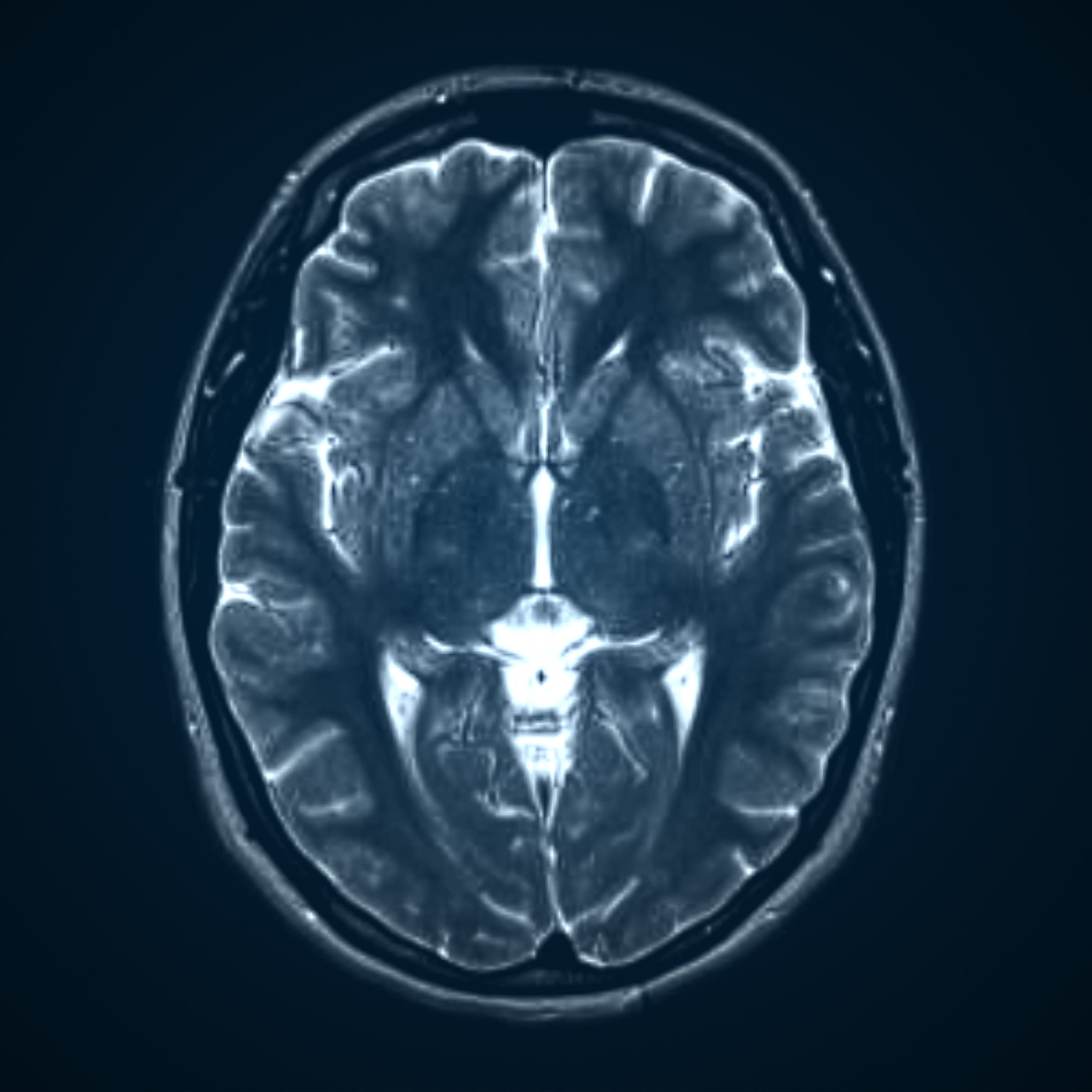 Brain Imaging: What Are the Different Types? | BrainLine