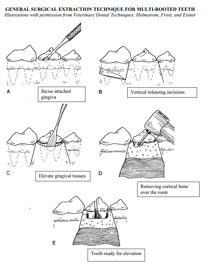 Dental Extraction Procedure
