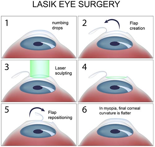 LASIK Eye Surgery · Top Eye Specialist | Best Rated NYC Ophthalmologist