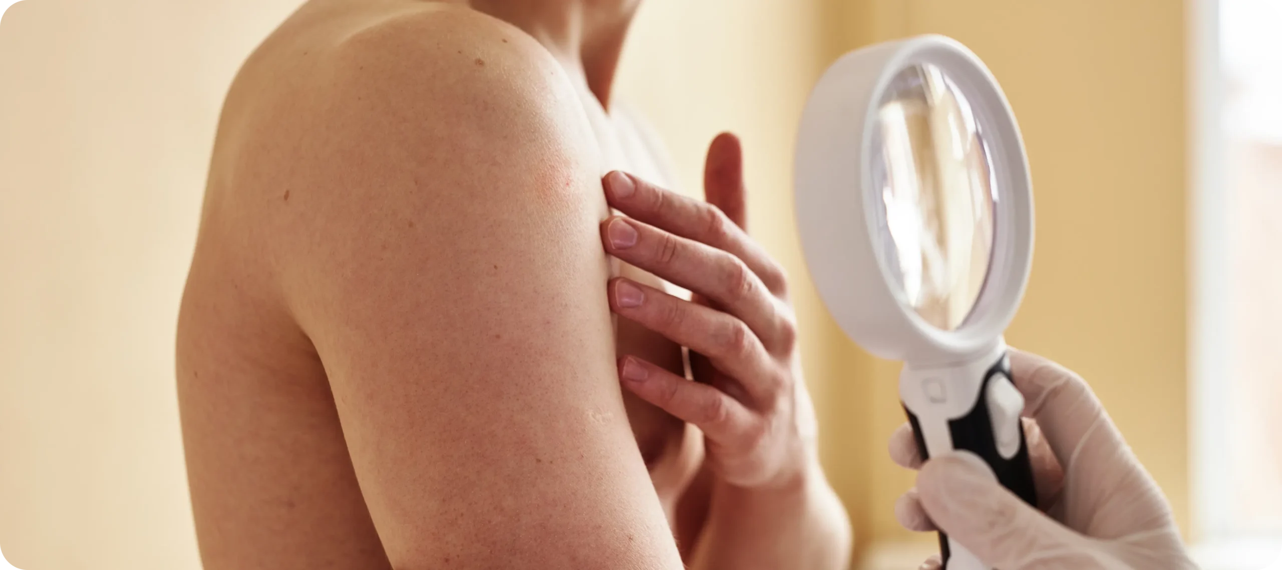 Full-Body Skin Exams: Learn What Dermatologists Look For