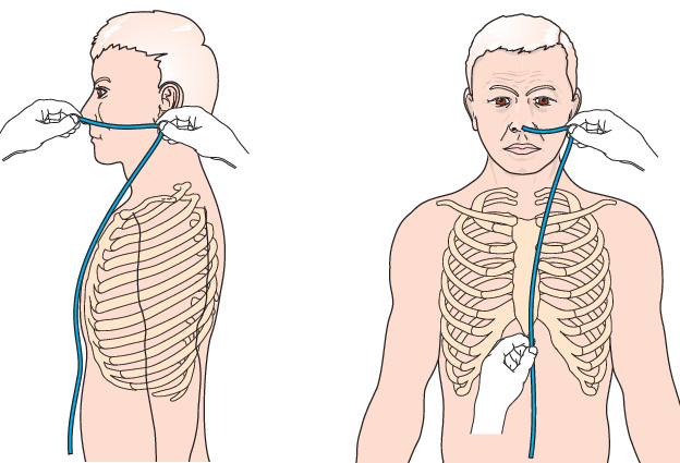 Установка зонда