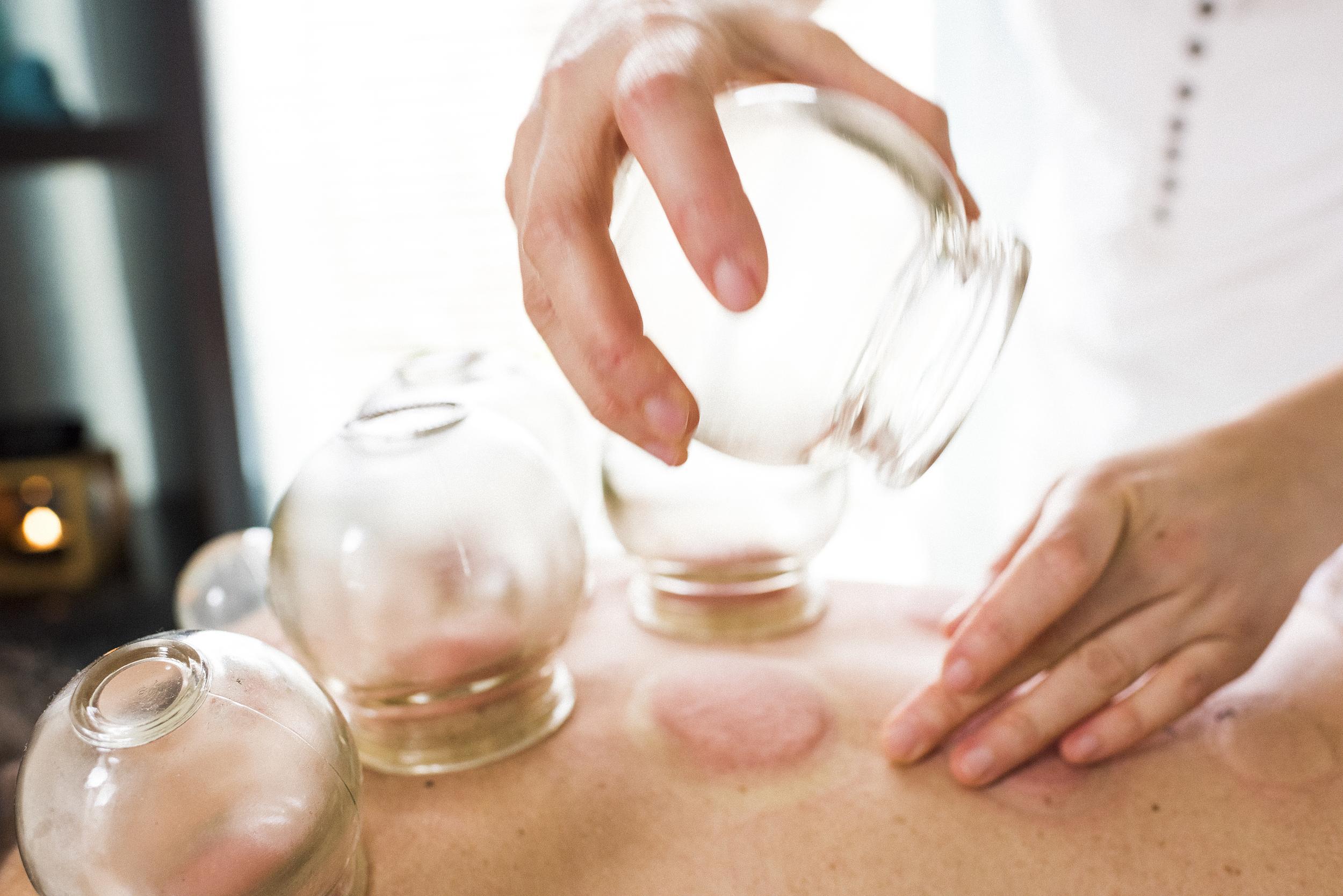 中医拔罐疗法操作示意图