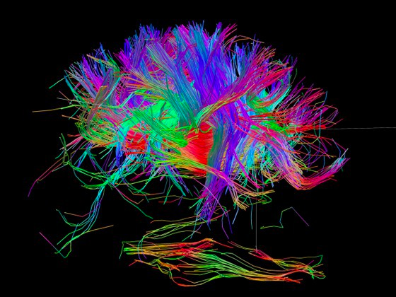 Abstract representation of neural networks and consciousness