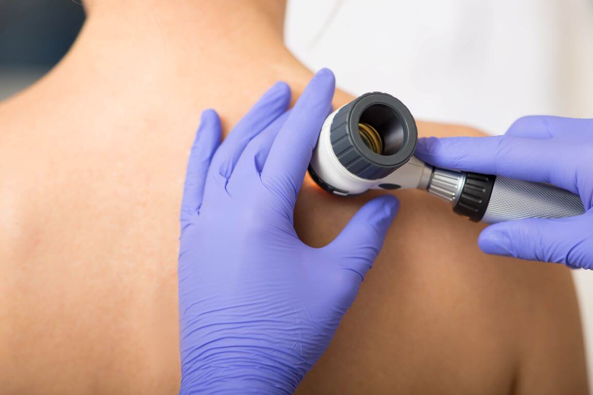 Understanding the Full Body Skin Exam
